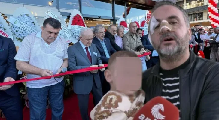 Burger King açılışında Dr Kemal Sağlam saldırıya uğradı